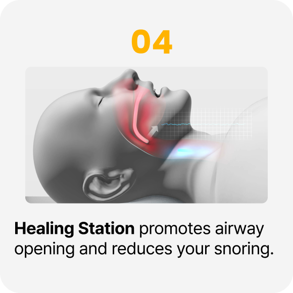 Healing Station promotes airway opening and reduces your snoring.